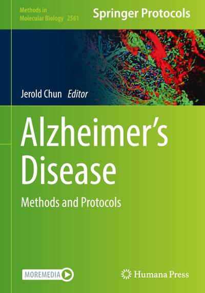 Alzheimer’s Disease