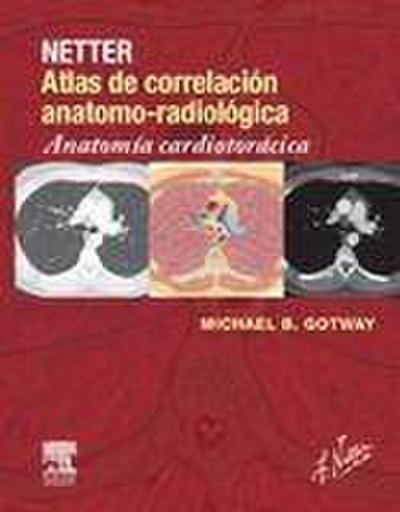 Netter. Atlas de correlación anatomo-radiológica: Anatomía c