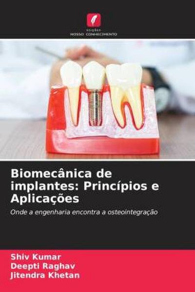 Biomecânica de implantes: Princípios e Aplicações