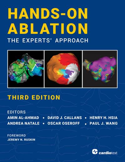 Hands-On Ablation, The Experts’ Approach, Third Edition