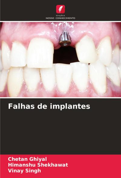 Falhas de implantes