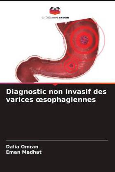 Diagnostic non invasif des varices ¿sophagiennes