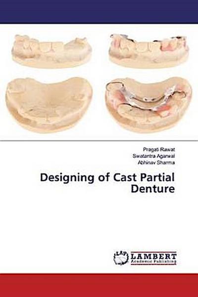 Designing of Cast Partial Denture