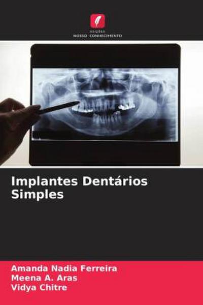 Implantes Dentários Simples