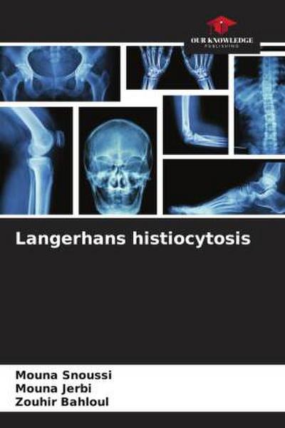 Langerhans histiocytosis