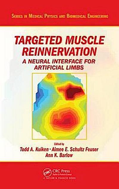 Kuiken, T: Targeted Muscle Reinnervation