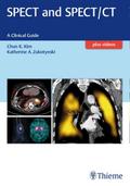 SPECT and SPECT/CT