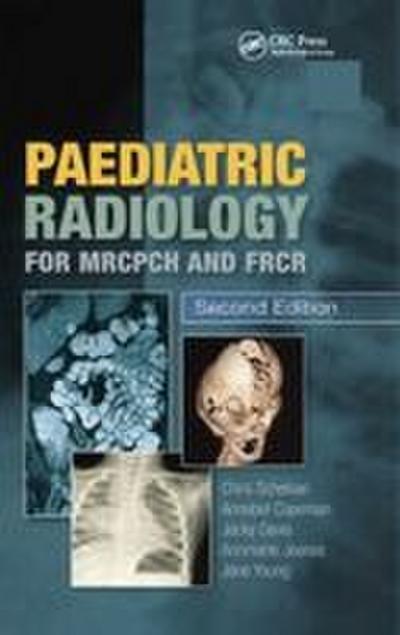 Paediatric Radiology for MRCPCH and FRCR, Second Edition