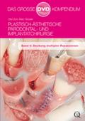 Plastisch-Ästhetische Parodontal- und Implantatchi