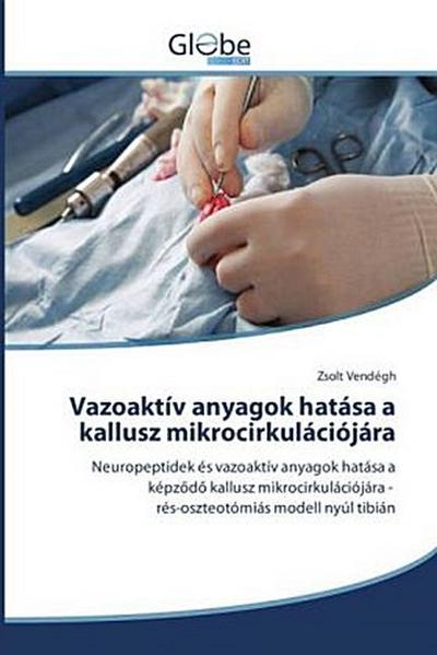 Vazoaktív anyagok hatása a kallusz mikrocirkulációjára