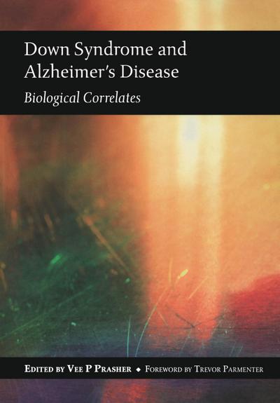 Down Syndrome and Alzheimer’s Disease