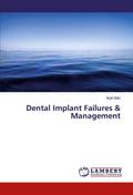 Dental Implant Failures & Management