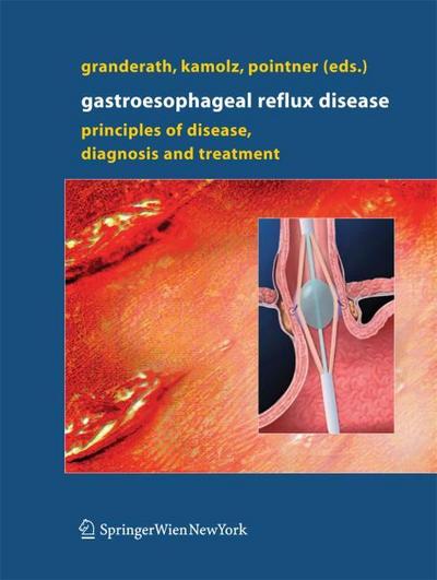 Gastroesophageal Reflux Disease