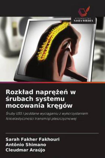 Rozk¿ad napr¿¿e¿ w ¿rubach systemu mocowania kr¿gów