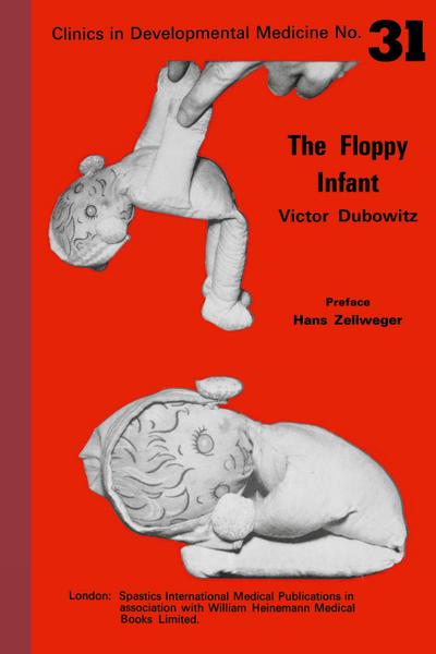 The floppy infant
