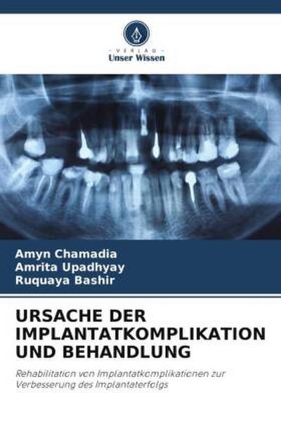 URSACHE DER IMPLANTATKOMPLIKATION UND BEHANDLUNG