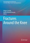 Fractures Around the Knee