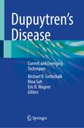 Dupuytren’s Disease