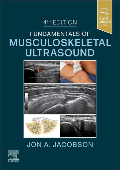 Fundamentals of Musculoskeletal Ultrasound