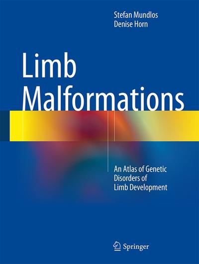 Limb Malformations