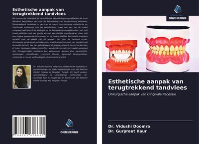 Esthetische aanpak van terugtrekkend tandvlees