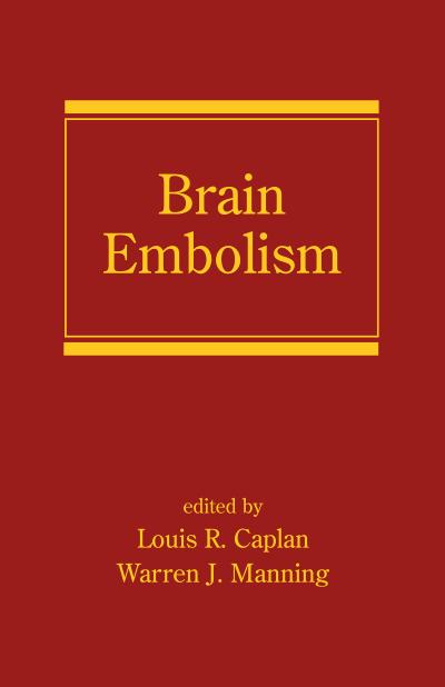 Brain Embolism