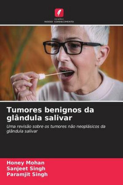 Tumores benignos da glândula salivar