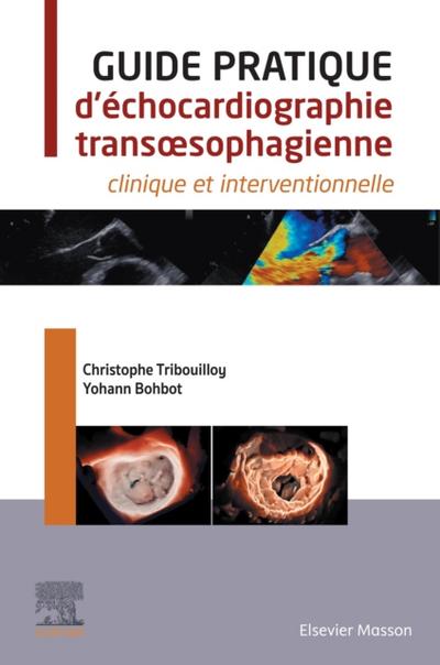 Guide pratique d’echocardiographie trans sophagienne