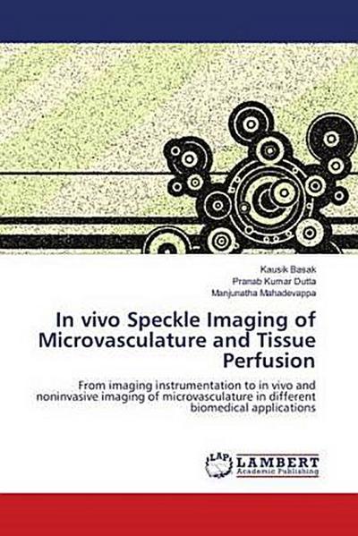 In vivo Speckle Imaging of Microvasculature and Tissue Perfusion