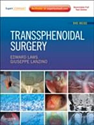 Transsphenoidal Surgery E-Book