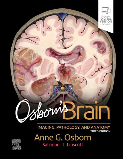 Osborn’s Brain