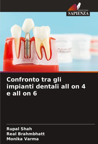 Confronto tra gli impianti dentali all on 4 e all on 6