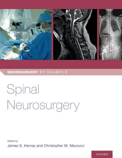 Spinal Neurosurgery