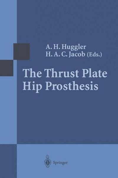 The Thrust Plate Hip Prosthesis