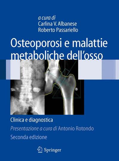 Osteoporosi e malattie metaboliche dell’osso