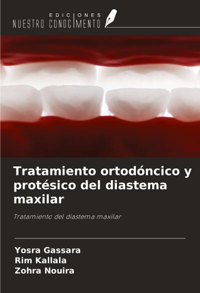 Tratamiento ortodóncico y protésico del diastema maxilar