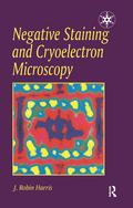 Negative Staining and Cryoelectron Microscopy