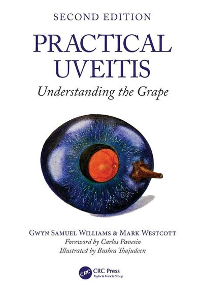 Practical Uveitis