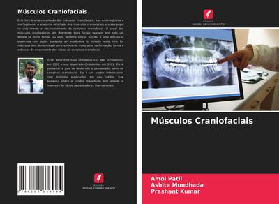 Músculos Craniofaciais - Amol Patil