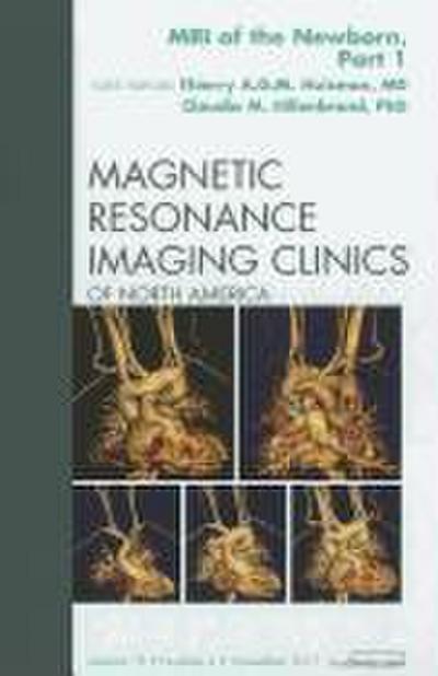 MRI of the Newborn, Part I, an Issue of Magnetic Resonance Imaging Clinics