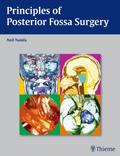 Principles of Posterior Fossa Surgery