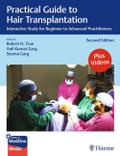 Practical Guide to Hair Transplantation