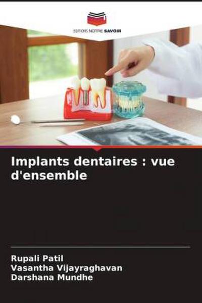 Implants dentaires : vue d’ensemble