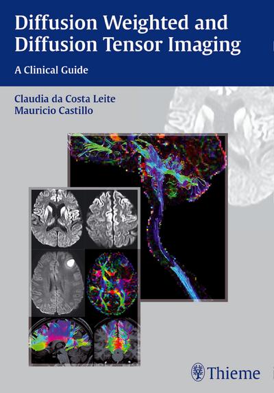 Diffusion Weighted and Diffusion Tensor Imaging: A Clinical Guide