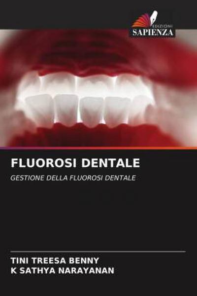 FLUOROSI DENTALE