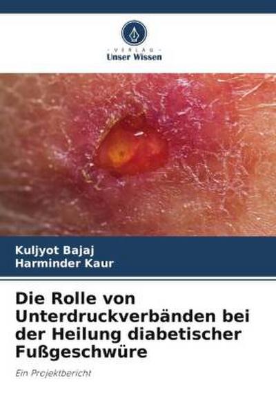 Die Rolle von Unterdruckverbänden bei der Heilung diabetischer Fußgeschwüre