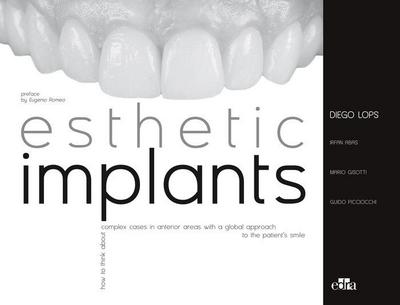 Esthetic Implants How to Think about Complex Cases in Anterior Areas with a Global Approach to the Patient Smile (2 Books)
