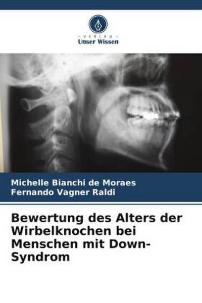 Bewertung des Alters der Wirbelknochen bei Menschen mit Down-Syndrom