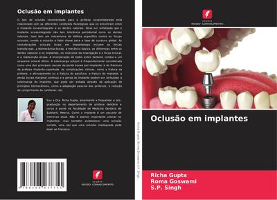 Oclusão em implantes