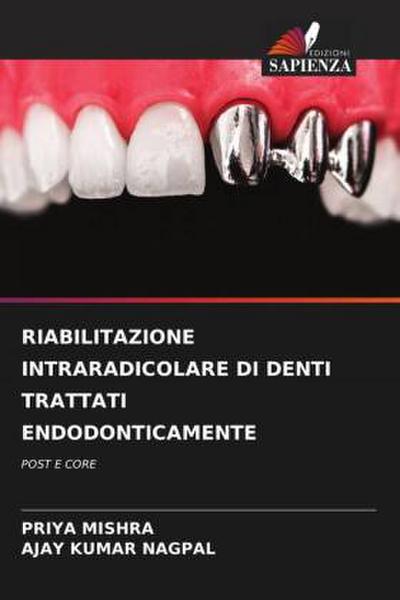 RIABILITAZIONE INTRARADICOLARE DI DENTI TRATTATI ENDODONTICAMENTE